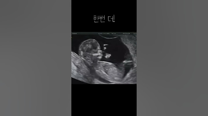 첫 공개! 12주차 태아(딸)의 점프실력!(초음파) #shorts