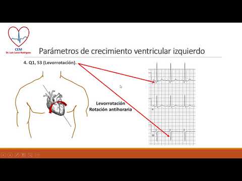 Vídeo: Efecto Del Aumento De La Masa Del Ventrículo Izquierdo En La Evaluación De La Isquemia En Las Señales Electrocardiográficas: Estudio De Corazón Aislado De Conejo