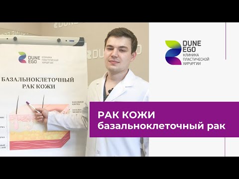 Рак кожи. Как лечат базальноклеточный рак в Новосибирске?
