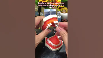WOW My Missing Teeth Can Be Saved 