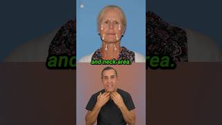 Vertical Facelift Case Study #deepplanefacelift #facelift