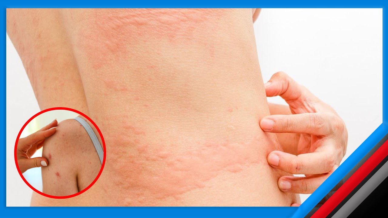 JE UNAWASHWA MWILI KILA UKITOKA KUOGA????.......PUMU YA NGOZI