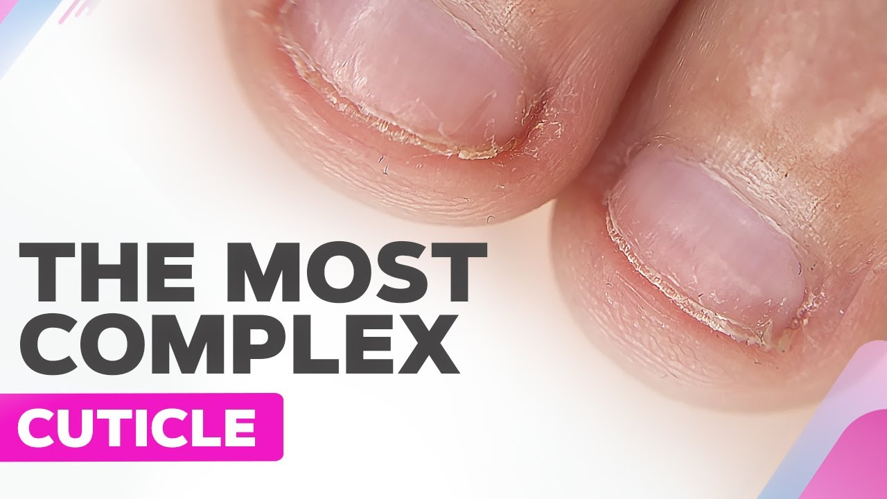 Transform Your Bitten Nails into Beautiful Healthy Nails
