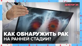 Как обнаружить РАК на ранней стадии? | Доктор 24