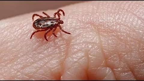 Mengungkap Peran Gen FTN_0096 pada Bakteri Francisella, Penyebab Tularemia | Penemuan Terbaru 2025