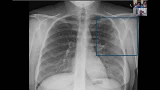 MC Podcast Trailer: Cant Miss X-rays Part 1