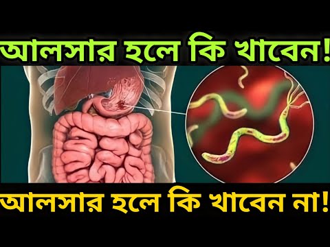 ভিডিও: খাওয়ায় কি আলসার হয় না?