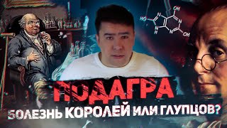 Подагра | Болезнь королей или глупцов?