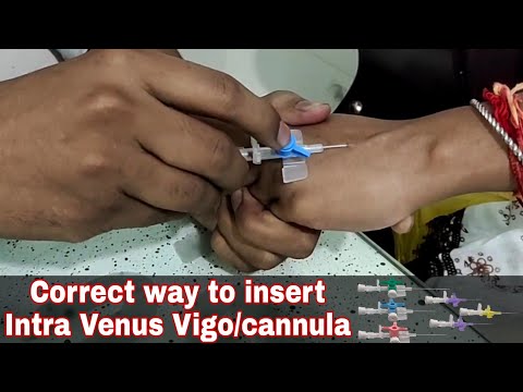 cannula kaise lagate hain in hindi | vigo kaise lagaya jata hai | vigo insert kaise karte hai