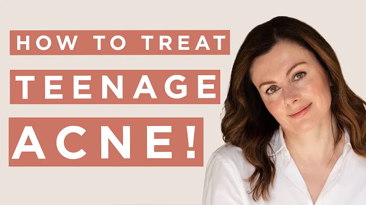 How To Treat Teen Acne | Dr Sam Bunting - DayDayNews