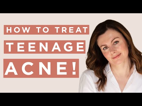 How To Treat Teen Acne | Dr Sam Bunting