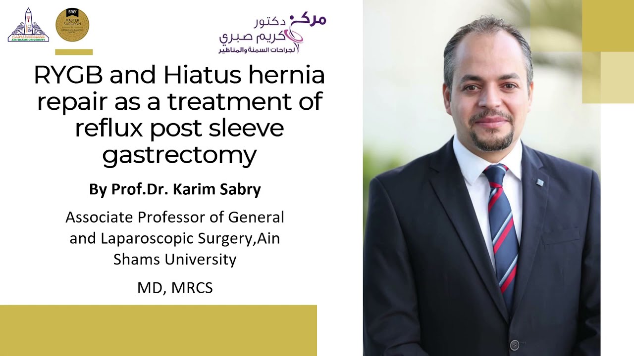 RYGB and hiatus hernia repair as a treatment of reflux post sleeve