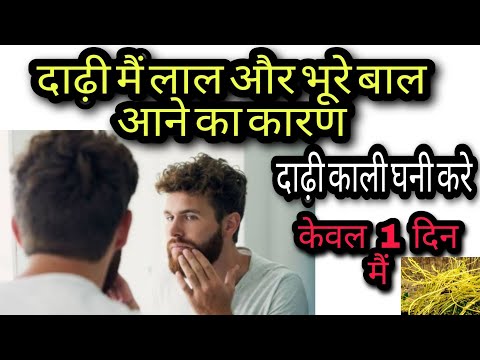 दाढ़ी मैं लाल और भूरे बाल क्यु आते है कारण क्या होता है | इलाज कैसे करें