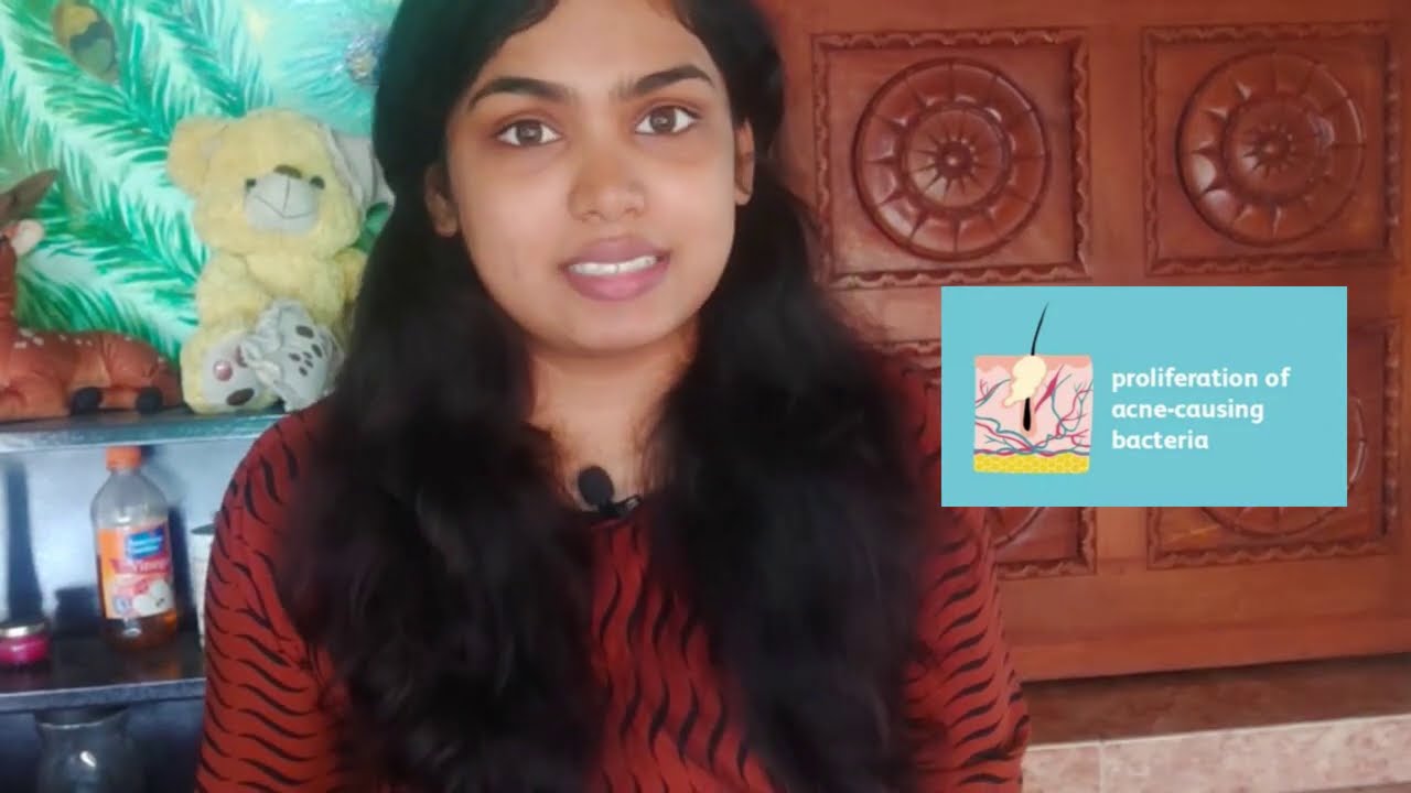 body-acne-how-to-get-rid-of-back-acne-shoulder-acne