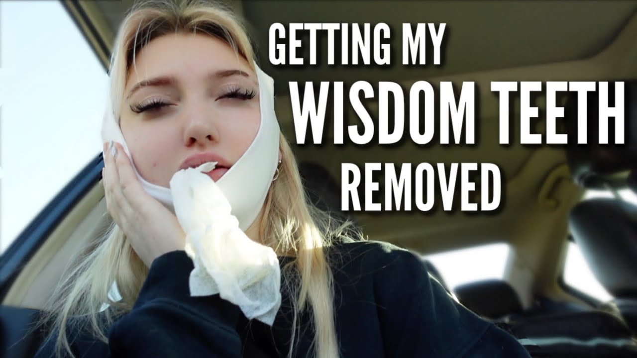 I GOT MY WISDOM TEETH OUT YouTube