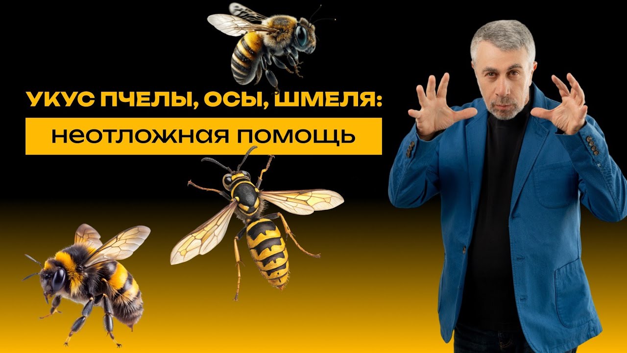 Укус пчелы, осы, шмеля: неотложная помощь