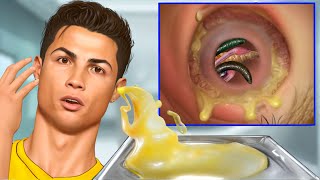 ASMR Remove Blackheads, Pustules \u0026 Parasitic Maggots Ear | Deep Cleaning Animation