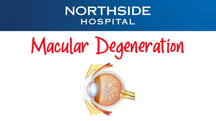 Age-Related Macular Degeneration: Causes, Symptoms, and Treatment Options