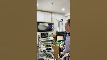 U dưới niêm mạc dạ dày.