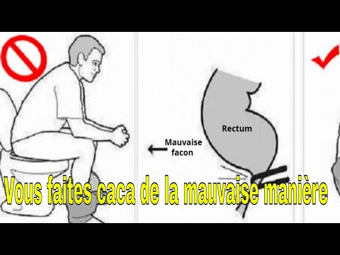 Vidéo: Qu'est-ce Qu'un Mouvement Intestinal Normal? Plus Des Conseils Pour Mieux Caca