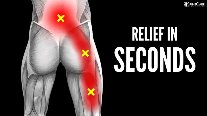 30 SECOND FIX: Instant Sciatica Pain Relief