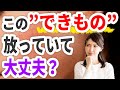 この【できもの】放っていて大丈夫？