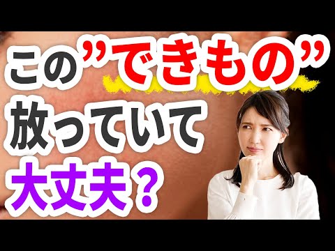 この【できもの】放っていて大丈夫？