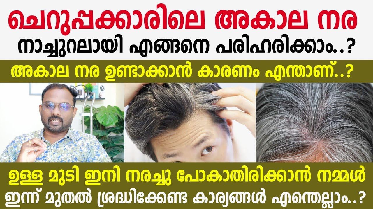 ചെറുപ്പക്കാരിലെ അകാല നര (Gray Hair) നാച്ചുറലായി പരിഹരിക്കാം; ഉള്ള മുടി നരക്കില്ല | ഇനി മുടി കറുക്കും