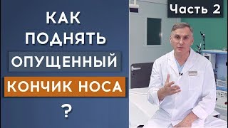 КОРЕКЦИЯ КОНЧИКА НОСА ❗️ПОЧЕМУ СЛОЖНАЯ ОПЕРАЦИЯ ➡️ЧАСТЬ 2