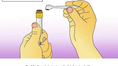 MK 01387 : OMNIgene gut ( OM-200 ) animated instruction collection video with audio in Icelandic