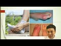 4. Канчап аарый бээрил оорга?