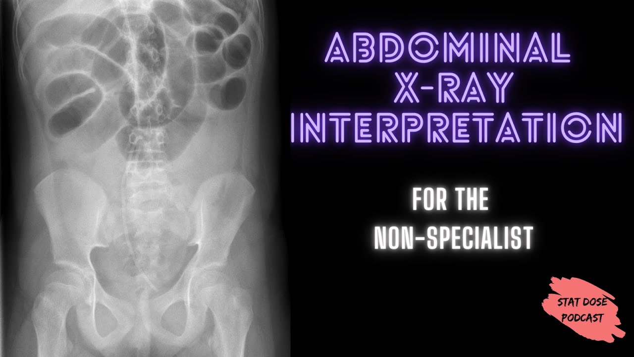 abdominal x ray case study