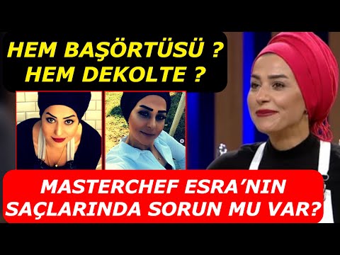 Masterchef Esra Tokelli’nin Saçlarında Sorun Mu Var? Başörtüsü Tarzının Sebebi...?