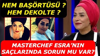 Masterchef Esra Tokelli’nin Saçlarında Sorun Mu Var? Başörtüsü Tarzının Sebebi...? Resimi