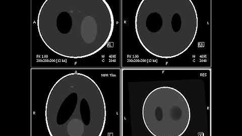 Volume rendering and MPRs of 3D Shepp-Logan Phantom