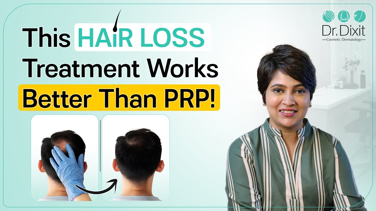 PRP vs GFC Which is better? Best Hair fall treatment in Bangalore