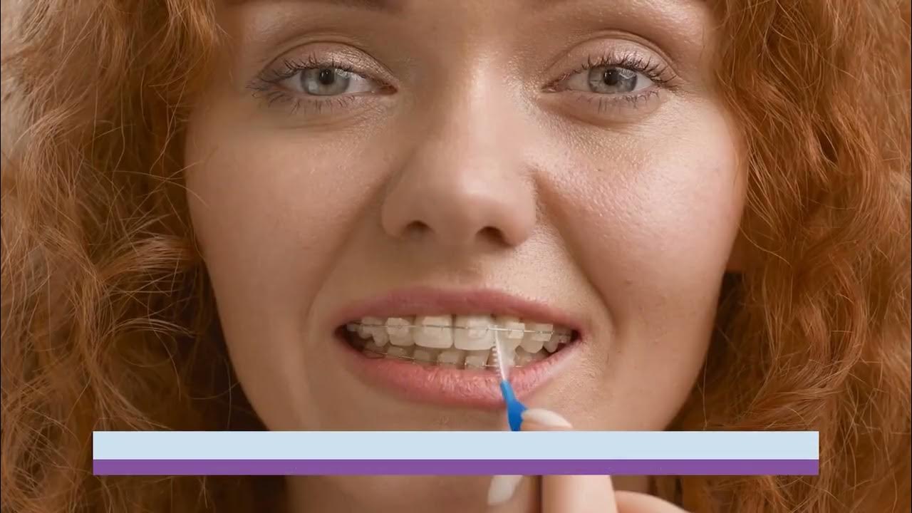 Limiting how much sugar you eat with braces YouTube