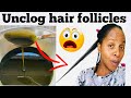 DIY AYURVEDIC HAIR OIL for extreme  NATURAL HAIR Growth &amp; Retention !! Ayurvedic hair growth oil