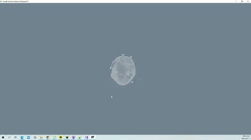 VTK Python Test - FixedPointVolumeRayCastMapperCT - MIP