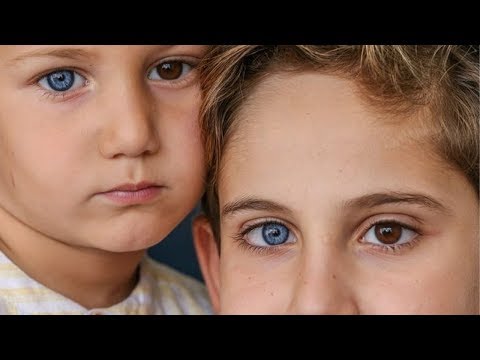 Video: Ngjyra më e rrallë e syve - cila është ajo?