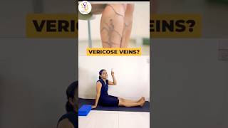 Yoga for Varicose Veins Relief | Improve Blood Circulation Naturally #youtubeshorts #yogaflow