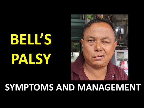 What is Bells Palsy? How long does it take to recover? @DentCareNepal