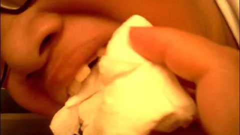 Madeline Sanchez tooth removal 123