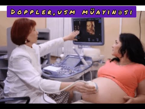 Video: Tibbi baxımdan Doppler nə deməkdir?