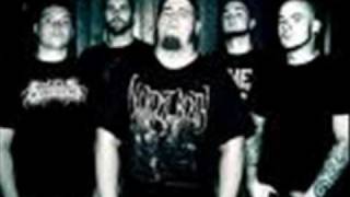 Annotations Of An Autopsy - Human Dust