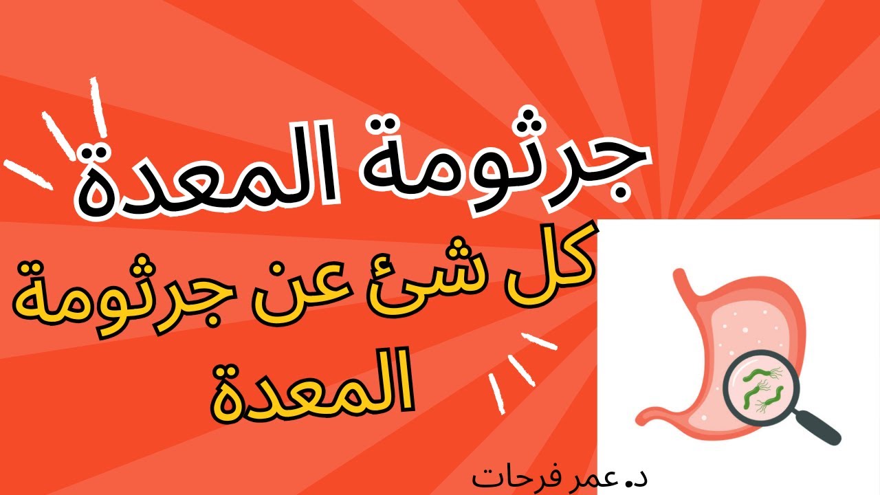 كل ما تود معرفته عن جرثومة المعدة