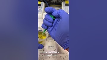 Urine Drug Screen: How it’s Done 🧪