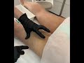 Tratamientos corporales de Medicina Estetica / Процедуры для тела Эстетической медицины