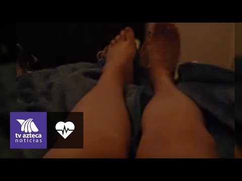 Video: ¿No puedes levantar la pierna cuando estás sentado?