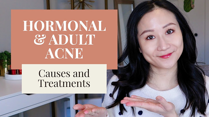 Dermatologist recommended skin care routine for hormonal acne